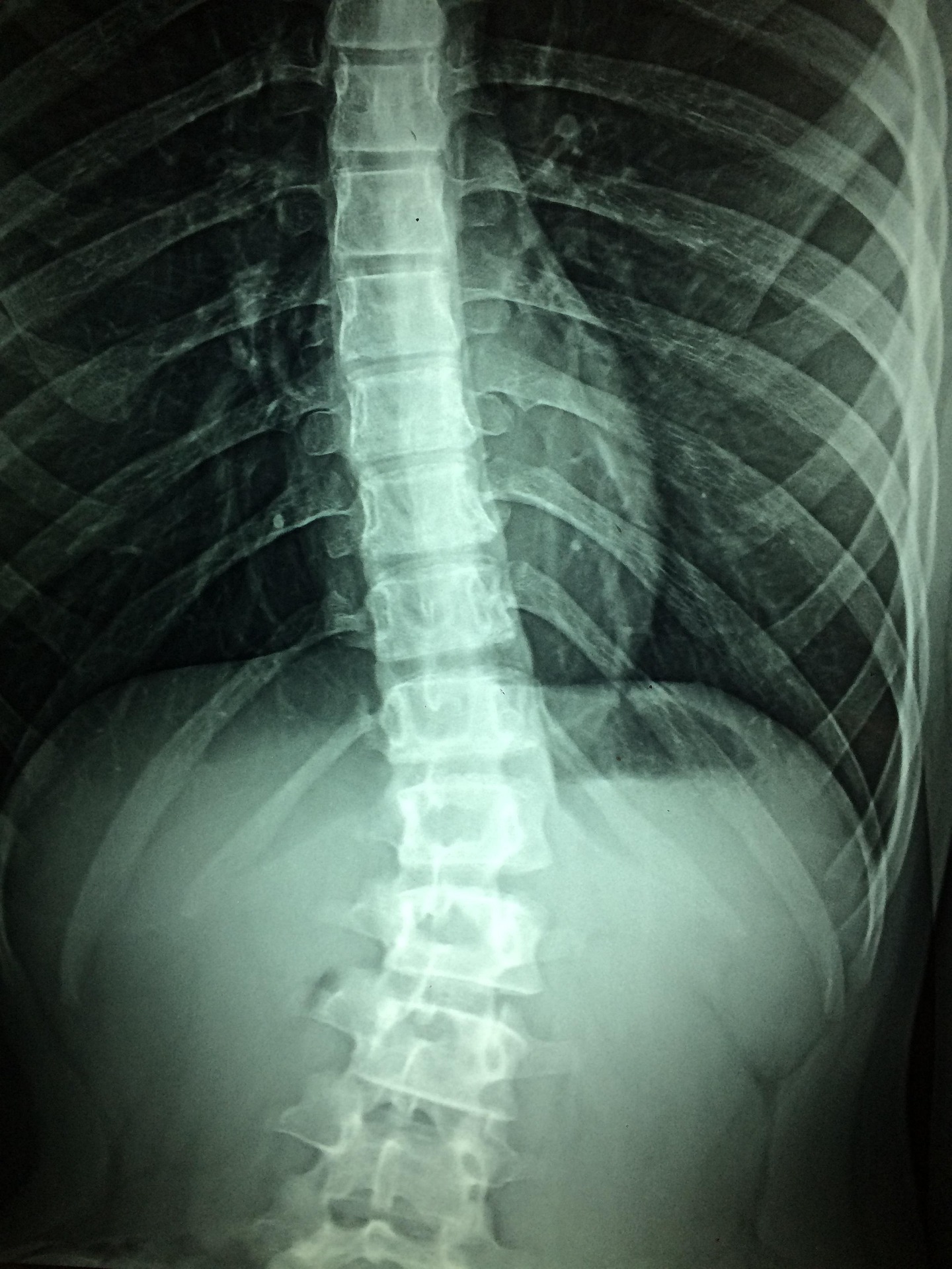 Sanatoriul Balnear Techirghiol vizează transformarea într-un centru național de reabilitare pediatrică