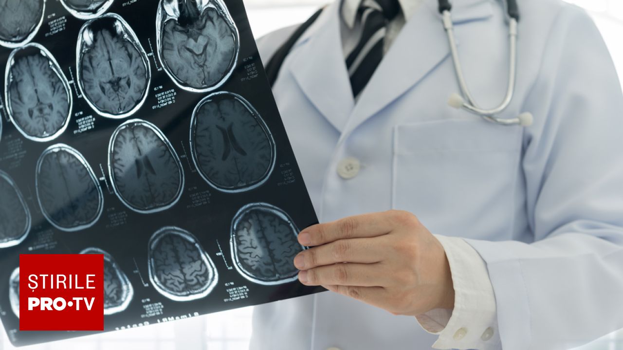 Accesul limitat la neuroreabilitare în România: doar 30% dintre pacienții cu AVC beneficiază de recuperare