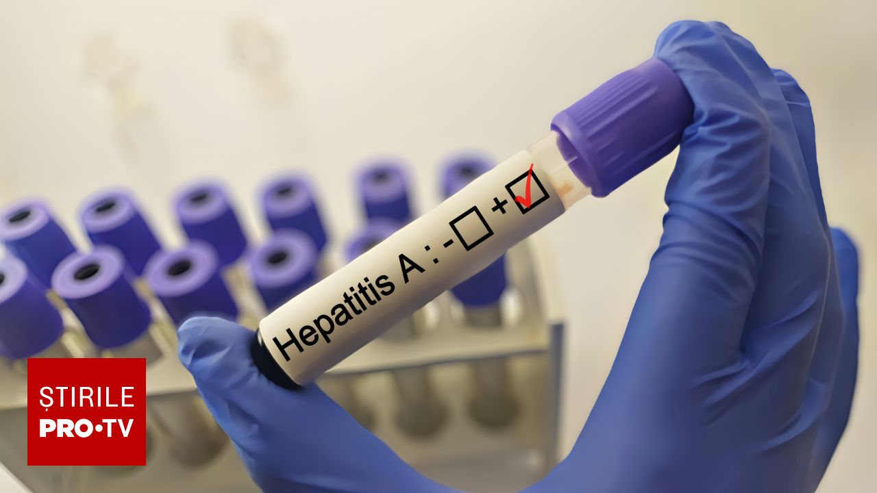 Focare de hepatită A în județul Brașov: 85 de cazuri raportate de la începutul anului școlar
